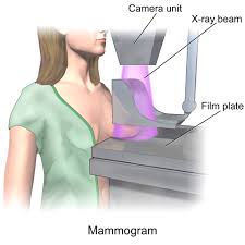 Mammografia – jak przebiega to badanie i kiedy należy je wykonywać?